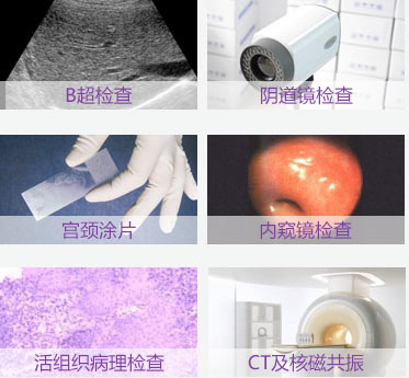 妇科肿瘤